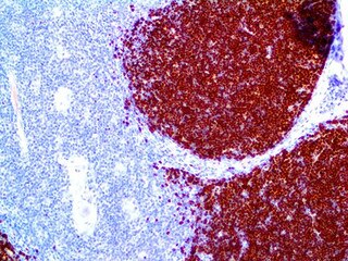 IHC of TdT on an FFPE Thymus Tissue